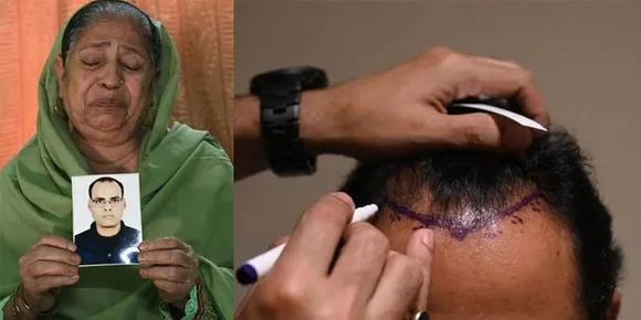 ഹെയർ ഫിക്‌സിംഗ് ശസ്ത്രക്രിയയ്ക്ക് വിധേയനായ യുവാവിന് ദാരുണാന്ത്യം; 4 പേർ അറസ്റ്റിൽ