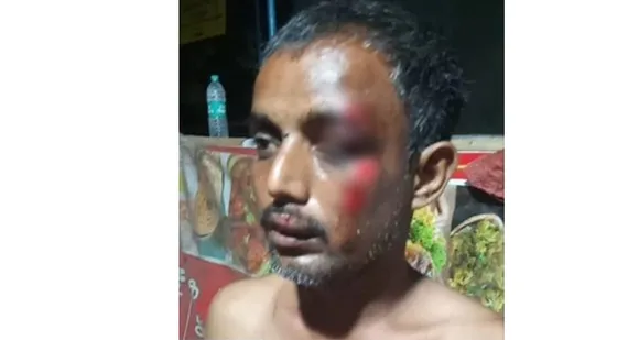 കൊടുവള്ളിയിൽ അതിഥി തൊഴിലാളിയെ കവർച്ചാ സംഘം ബൈക്കിൽ വലിച്ചിഴച്ചു