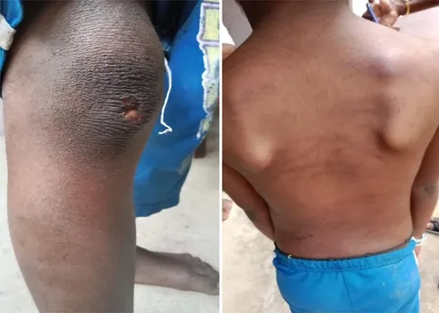 രാത്രികളിൽ കുട്ടികളുടെ ഉറക്കെയുള്ള നിലവിളിയും മുതിര്‍ന്നവരുടെ  ആക്രോശവും; അന്വേഷിച്ചെത്തിയപ്പോൾ കാണുന്നത് അഞ്ച് വയസുകാരിയുടെ ദേഹത്ത് പത്ത് മുറിവുകളും ചതവുകളും ഏഴ് വയസുകാരിയുടെ ശരീരത്തില്‍ 14 ചതവുകളും മുറിവുകളും; നെടുങ്കണ്ടത്ത് മദ്യ ലഹരിയില്‍ കുരുന്നുകള്‍ക്ക് നേരെ കൊടും ക്രൂരത, അമ്മാവനും പിതാവും കസ്റ്റഡിയില്‍