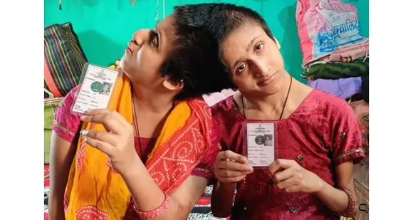 വിധിയുടെ ക്രൂരവിനോദം … ! ആരെങ്കിലും ഓർക്കുന്നുവോ ഉടൽ വെവ്വേറെയെങ്കിലും തലതമ്മിൽ ഒട്ടിയിരിക്കുന്ന ജന്മവൈകല്യത്തിൽ പിറന്ന ബീഹാറിലെ 'സബാ-ഫർഹാ' സഹോദരിമാരെ ?