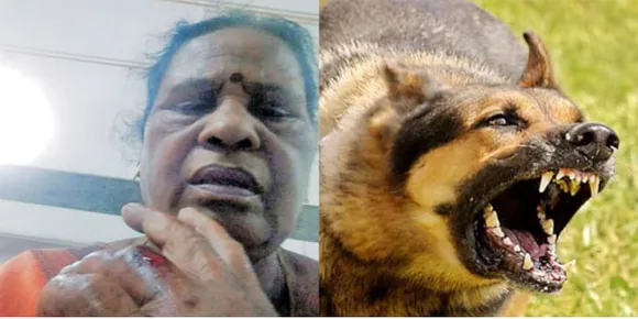 തെരുവുനായകള്‍ക്ക് ഭക്ഷണം നല്‍കുന്നതിനിടെ സീരിയൽ നടിക്ക് കടിയേറ്റു