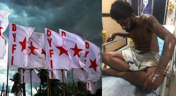 വീട്ടിലേക്ക് പോകവെ ബൈക്ക് കൈകാട്ടി നിര്‍ത്തി, ദേഹത്തേക്ക് ആസിഡ് ഒഴിച്ചു; ഡിവൈഎഫ്‌ഐ കോതമംഗലം ബ്ലോക്ക് പ്രസിഡണ്ട് ഗുരുതരാവസ്ഥയില്‍