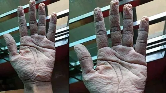 കോവിഡ് മുൻനിര പോരാളികൾക്ക് സല്യൂട്ട് !!