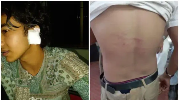 വടകര വില്ല്യാപ്പള്ളി എംഇഎസ് കോളേജിൽ സീനിയർ വിദ്യാർത്ഥികൾ രണ്ടാം വർഷ ബിരുദ വിദ്യാർത്ഥികളെ മർദ്ദിച്ചതായി പരാതി