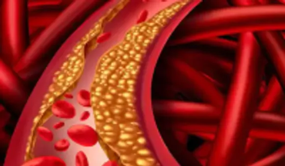 മോശം കൊളസ്ട്രോൾ കുറയ്ക്കാൻ പ്രധാനമായി ശ്ര​ദ്ധിക്കേണ്ട ചില കാര്യങ്ങളിതാ...