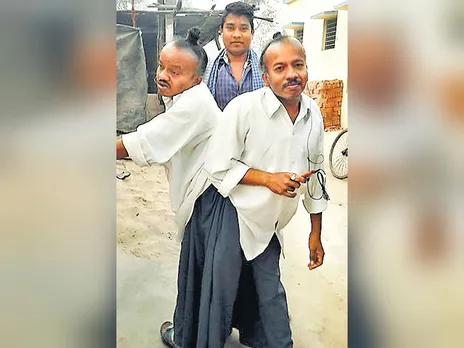 ഈ ഇരട്ടകൾക്കു 40 വയസ്സായി. ഇനിയവർക്കു നടക്കാനാകില്ല