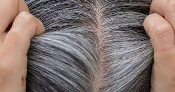 അകാലനര അകറ്റാൻ വീട്ടിൽ ചെയ്യാവുന്ന ചില കാര്യങ്ങൾ...