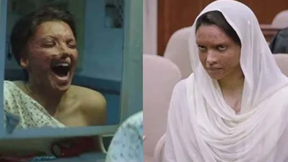 ആസിഡ് ആക്രമണത്തിനിരയായ പെണ്‍കുട്ടിയുടെ കഥയുമായി ദീപികയും