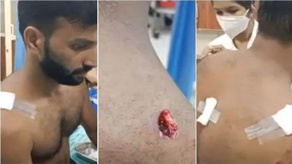 പാലക്കാട് ടാപ്പിങ്ങ് തൊഴിലാളിക്ക് കടുവയുടെ ആക്രമണത്തില്‍ പരിക്കേറ്റു