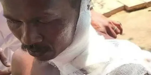 വയനാട്ടിൽ തേൻ ശേഖരിക്കാൻ ഭാര്യക്കൊപ്പം കാട്ടിൽ പോയ യുവാവിന് നേരെ കരടിയുടെ ആക്രമണം : ഗുരുതര പരിക്ക്