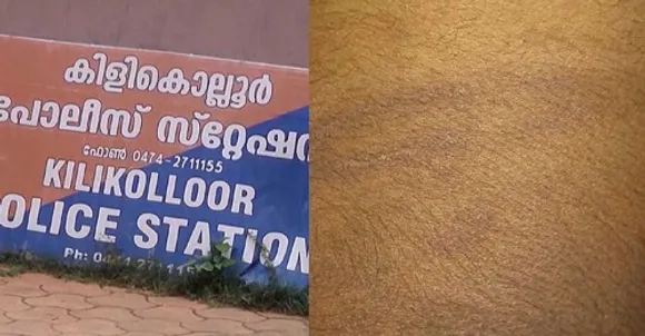 കിളികൊല്ലൂരില്‍ സൈനികനെ മര്‍ദിച്ച പൊലീസുകാര്‍ക്കെതിരെ നടപടി ആവശ്യപ്പെട്ട് കേന്ദ്രപ്രതിരോധമന്ത്രിക്ക് പരാതി