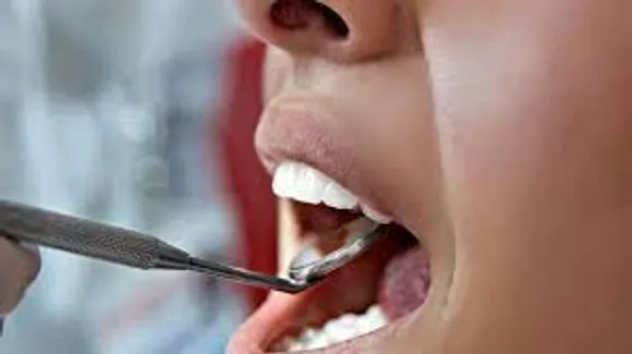 വായിലെ ക്യാന്‍സര്‍ അഥവാ വദനാര്‍ബുദത്തിന്റെ ലക്ഷണങ്ങൾ എന്തൊക്കെയാണെന്ന് നോക്കാം..