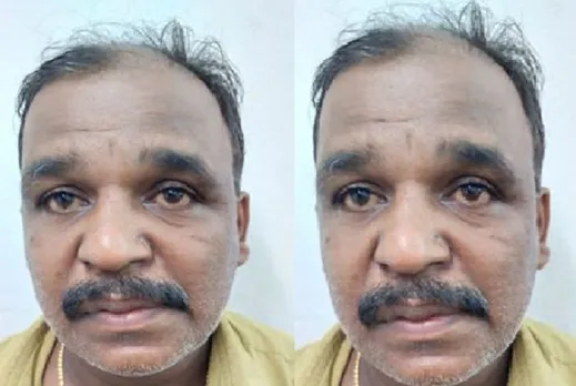 നെടുമങ്ങാട് ലോട്ടറി വിൽപനക്കാരനെ മർദിച്ച് ടിക്കറ്റ് തട്ടിയെടുത്തയാളെ പൊലീസ് അറസ്റ്റു ചെയ്തു