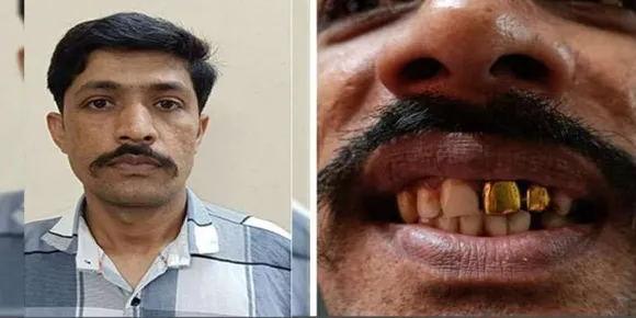 15 വർഷമായി ഒളിവിൽ കഴിഞ്ഞ പ്രതിയെ ഗുജറാത്തിൽ നിന്നും പിടികൂടി; പിടിക്കാൻ സഹായിച്ചത് 'സ്വർണ്ണം പൂശിയ പല്ലുകൾ'