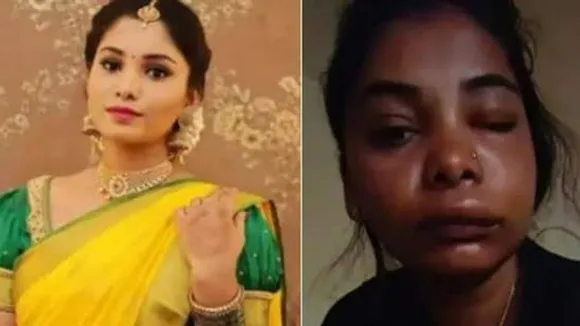 റൂട്ട് കനാല്‍ ശസ്‍ത്രക്രിയയിലെ ഗുരുതര പിഴവ് മൂലം മുഖം തിരിച്ചറിയാനാകാതെ കന്നഡ നടി സ്വാതി സതീഷ്.
