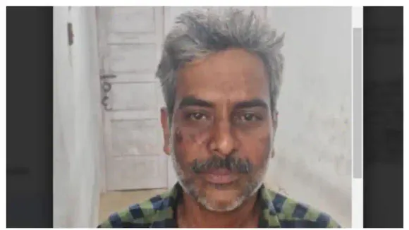 വാക്കു തർക്കം: പാചകം ചെയ്യുകയായിരുന്ന ഭാര്യയുടെ മുഖത്ത് തിളച്ച എണ്ണയൊഴിച്ചു, ഗുരുതര പരിക്ക്; ഭർത്താവ് അറസ്റ്റിൽ