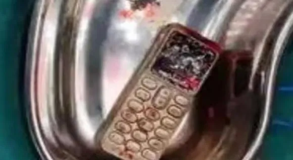 സഹോദരനുമായി വഴക്കിട്ട് യുവതി മൊബൈൽ വിഴുങ്ങി, 2 മണിക്കൂർ നീണ്ട ശസ്ത്രക്രിയയ്ക്ക് ഒടുവിൽ ഫോൺ പുറത്തെടുത്തു