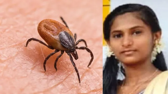 ചെള്ളുപനി ബാധിച്ച് പത്താം ക്ലാസ് വിദ്യാർഥിനി മരിച്ചു; പ്രതിരോധം ശക്തമാക്കുമെന്ന് മന്ത്രി; രോഗലക്ഷണമുള്ളവര്‍ ഉടന്‍ വൈദ്യസേവനം തേടണം