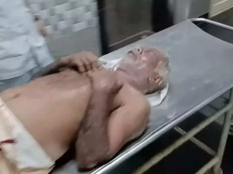 രാത്രിയിൽ വീടിനുള്ളിൽ വിശ്രമിക്കവേ ആസിഡ് ആക്രമണത്തിൽ വയോധികന് കണ്ണിന് പരുക്ക്; സംഭവം ഇടുക്കിയിൽ