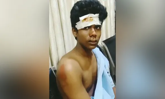 എഴുകോണിൽ കെഎസ്ആർടിസി ബസ്സിൽ നിന്നു തെറിച്ചുവീണ വിദ്യാർഥിക്ക് ഗുരുതര പരിക്ക് ! ബസ് നിർത്താതെ പോയി