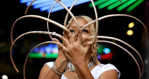 ഗിന്നസ് വേള്‍ഡ് റിക്കാര്‍ഡില്‍ ഇടം നേടിയ നഖങ്ങള്‍ നീക്കം ചെയ്തു