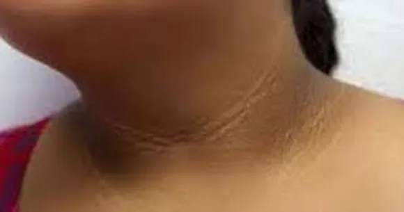 പല കാരണങ്ങള്‍ കൊണ്ടും കഴുത്തിന്‍റെ നിറം മങ്ങിപ്പോകാം; അവ മാറാനുള്ള വഴികൾ എന്തൊക്കെയാണെന്ന് നോക്കാം...