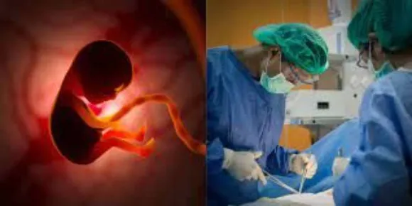 ഗര്‍ഭസ്ഥ ശിശുവിന് ബ്രെയിന്‍ സര്‍ജറി; ലോകത്ത് ആദ്യം