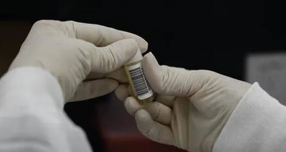 കോവിഡ് ‑19 രോഗികളിൽ രണ്ടാംഘട്ട മരുന്ന് പരീക്ഷണം നടത്താൻ കൊച്ചി ആസ്ഥാനമായ ഇന്ത്യയിലെ പ്രമുഖ മരുന്ന് ഗവേഷണ കമ്പനിയായ പിഎൻബി വെസ്‌പെർ ലൈഫ് സയൻസ് പ്രൈവറ്റ് ലിമിറ്റഡിന് ഡ്രഗ് കൺട്രോളർ ജനറൽ ഓഫ് ഇന്ത്യയുടെ (ഡിസിജിഐ) അനുമതി ലഭിച്ചു