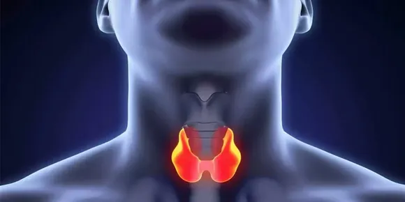 തൈറോയ്ഡ് അകറ്റാന്‍ ഒരു ഒറ്റമൂലി