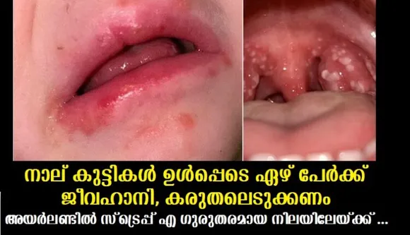 നാല് കുട്ടികള്‍ ഉള്‍പ്പെടെ ഏഴ് പേര്‍ക്ക് ജീവഹാനി, കരുതലെടുക്കണം, അയര്‍ലണ്ടില്‍ സ്ട്രെപ്പ് എ ഗുരുതരമായ നിലയിലേയ്ക്ക് നീങ്ങുന്നു