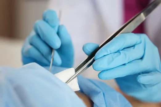 ഒരു വര്‍ഷം കൊണ്ട് എട്ടാം ക്ലാസുകാരി കഴിച്ചത് ഒരു കിലോയോളം മുടി;  ഓൺലൈൻ ക്ലാസുകളോടുള്ള വെറുപ്പിനെ തുടർന്നാണു പെൺകുട്ടി മുടി കഴിച്ചു തുടങ്ങിയതെന്നു ഡോക്ടർമാർ