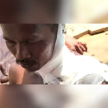 തേൻ തേടി ഭാര്യക്കൊപ്പം കാടുകയറിയ ആദിവാസി യുവാവിന് കരടിയുടെ ആക്രമണത്തിൽ  ഗുരുതര പരിക്ക്