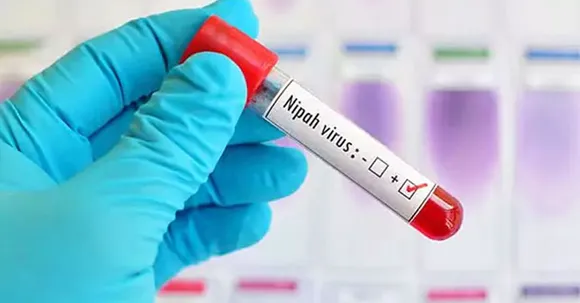 സംസ്ഥാനത്തെ നിപ ഭീതി ഒഴിയുന്നു, മരിച്ച കുട്ടിയുമായി ഏറ്റവും അടുത്ത സമ്പർക്കം പുലർത്തിയ 20 പേരുടെയും ഫലം നെഗറ്റീവായി