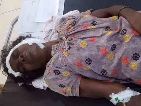 തലയ്ക്ക് ക്ഷതം, ഇടതു ചെവി അറ്റ നിലയിൽ, എല്ലുകൾക്ക്  പൊട്ടൽ;  പശുവിന് വെള്ളം കൊടുക്കാൻ പോയ വീട്ടമ്മയ്ക്ക് കാട്ടാനയുടെ ആക്രമണത്തിൽ ഗുരുതര പരിക്ക്