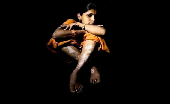 "സ്നേഹത്തിന്‍റെ വെള്ളപ്പാണ്ടുകൾ"  അച്ചു വിപിന്‍ .