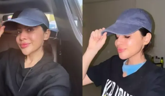 Uorfi Javed Shares Decision To Dissolve Chin Fillers, See Before-After