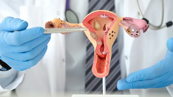 Fallopian Tubes