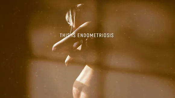 this is endometriosis