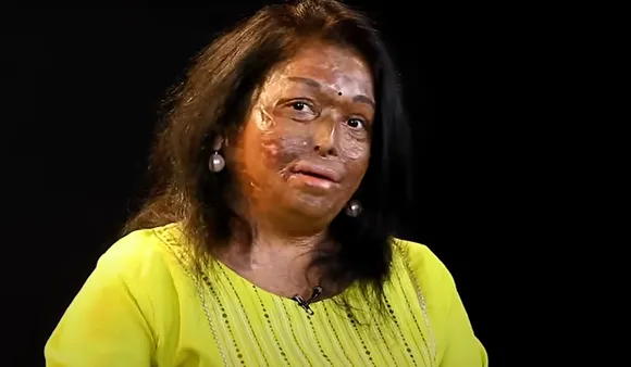 Sneha Jawle Burns Survivor