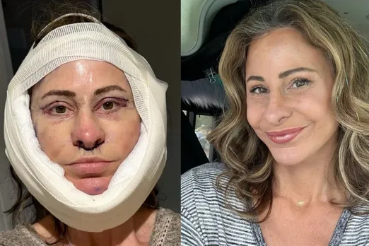 Kelly Beasley, 50, sold her house to go under the knife