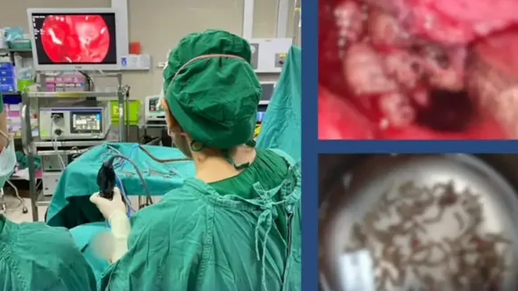 thai woman finds maggots in nose