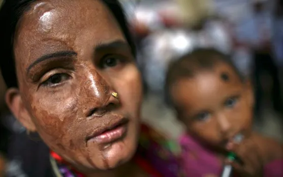 Acid Attacks