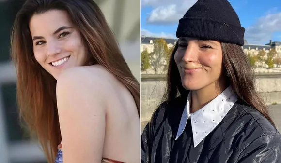 Model Injured In Dog Attack