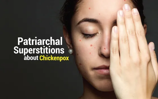 Chivkenpox and the patriarchal and religious superstitions about it