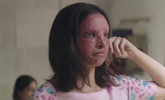 chhapaak trailer