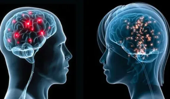 Women's Brain Shrink