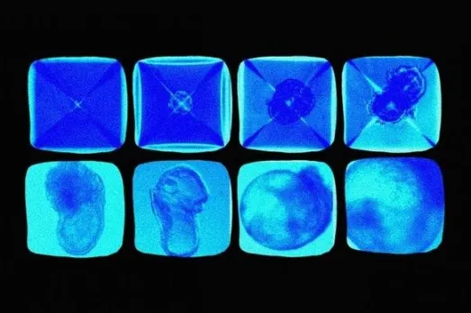 First synthetic embryo