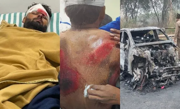 Rishabh Pant involved in major accident, injured severely