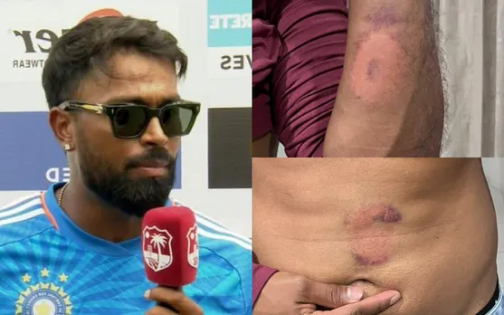 निकोलस पूरन ind vs wi nicholas pooran
