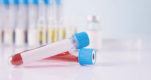 Blood Sugar Test